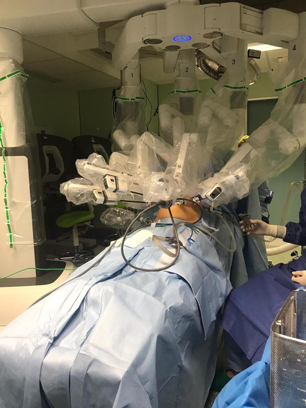 Première opération assistée par robot à l'UZ Brussel pour un syndrome de Dunbar