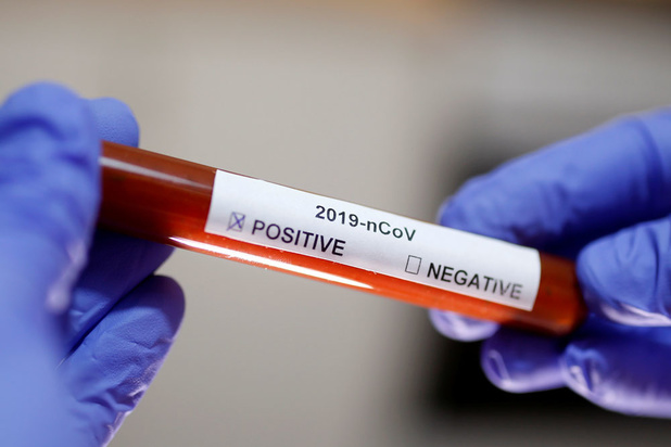 Coronavirus: er is voor beleggers geen reden tot paniek