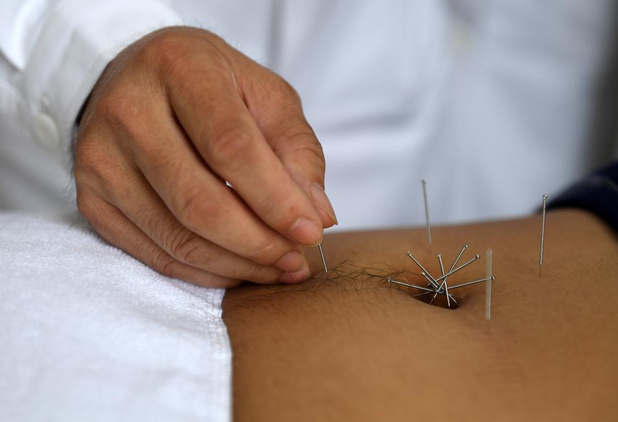 L'acupuncture efficace contre quoi? L'intrigant exemple de l'angine de poitrine