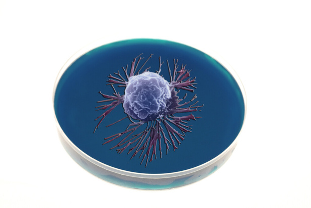 TONIC: Blocage de PD-1 dans le cancer du sein métastatique triple négatif