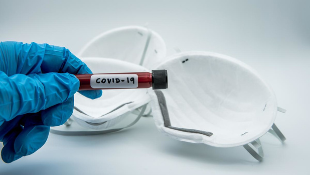 Niet iedereen mag een serologische test laten uitvoeren voor het coronavirus