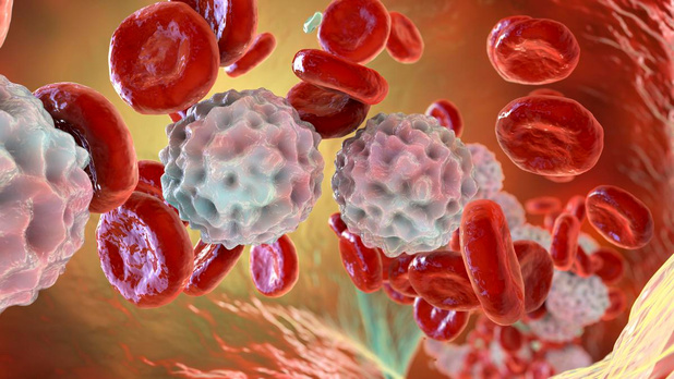 Des chercheurs belges découvrent un moyen d'enrayer une forme rare de lymphome