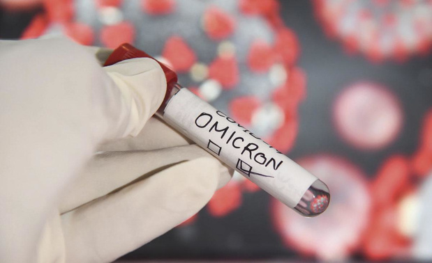 Monitoring Omicron: deux enquêtes sur l'offre et la demande de soins en médecine générale 