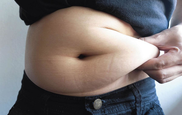 Covid-19 : les obèses plus susceptibles de développer une forme sévère 