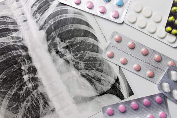 Les médicaments contre la tuberculose pourraient être moins chers, selon MSF
