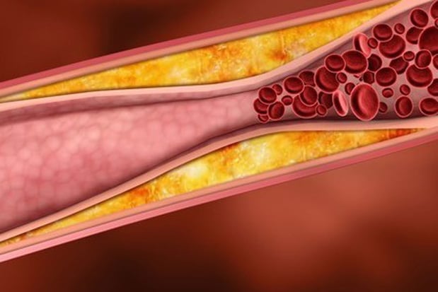Les oméga-3 peuvent-ils réduire le taux de cholestérol ?