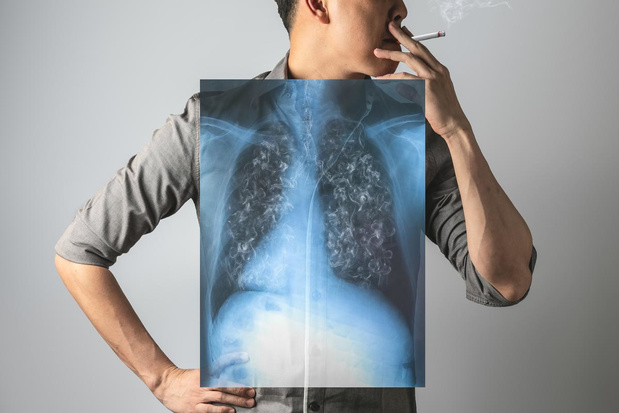 Atteint du cancer du poumon ? " Il l'a un peu cherché "