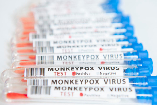 Les Etats-Unis déclarent l'épidémie de variole du singe urgence de santé publique