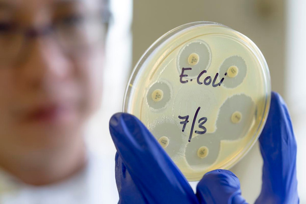 Antwerpse onderzoekers vinden gen dat blaasinfectie kan doen evolueren tot zware ziekte