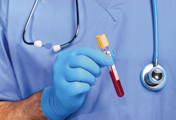 Pourquoi les tests sanguins restent en rade 