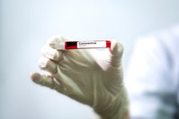 Coronavirus: comment la Belgique peut-elle suivre l'épidémie sans taux de positivité ?