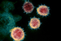Coronavirus en Belgique: la moyenne des nouvelles infections quotidiennes toujours autour des 2.000