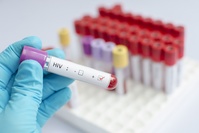 Sida : un nouveau variant du VIH plus virulent identifié aux Pays-Bas et en Belgique