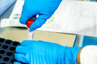 Covid: les tests antigéniques rapides déployés dans les hôpitaux et centres de triage