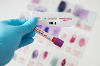 Coronavirus: pourquoi ne pas tout axer sur les tests sanguins? (analyse)