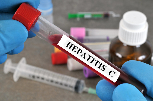 Hepatitis C: vaker herinfectie bij MSM