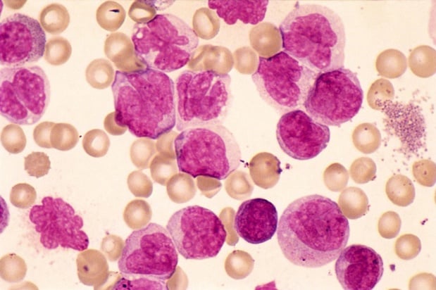 L'EMA approuve l'asciminib dans la leucémie myéloïde chronique