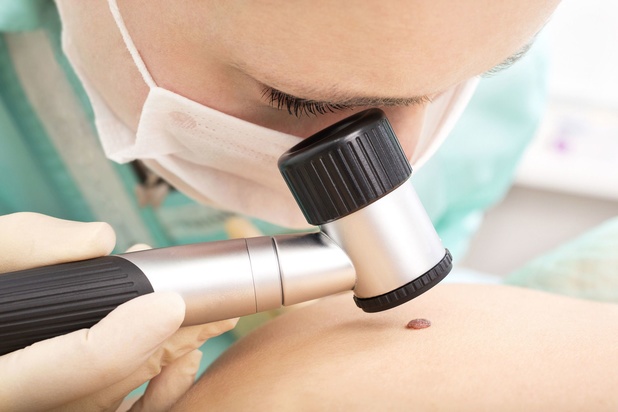 Une recherche belge confirme les bienfaits de l'immunothérapie sur le cancer de la peau