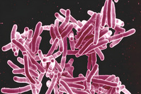 Les cas de tuberculose augmentent en Belgique: 