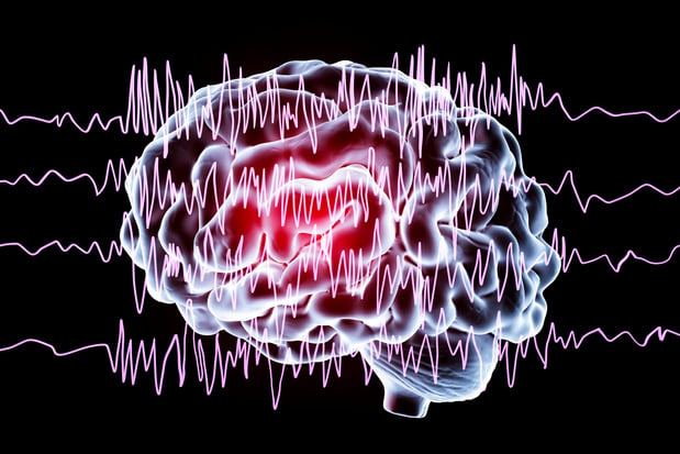 Epilepsie: gerichte ultratonen kunnen de frequentie van epilepsieaanvallen verlagen