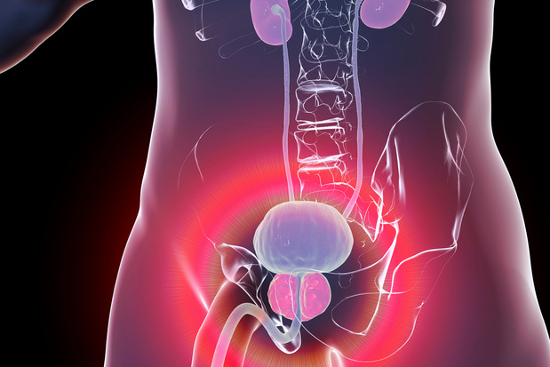 Cancer de la prostate : des bactéries intestinales favoriseraient sa croissance