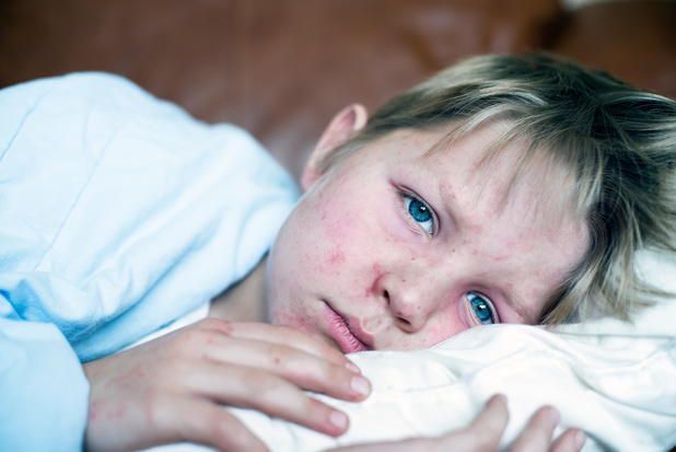 Geen mazelenvaccin meer voor volwassenen