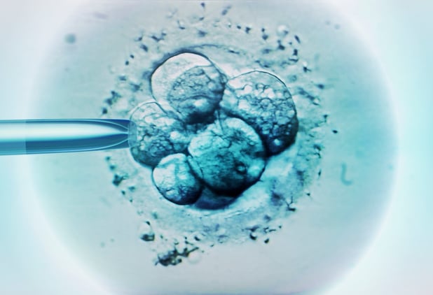 Eerste geboorte met een nieuwe techniek van in-vitrofertilisatie