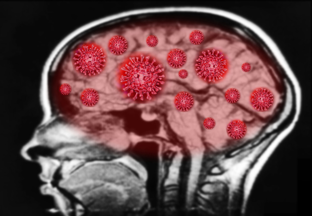 Le coronavirus est capable de s'attaquer au cerveau