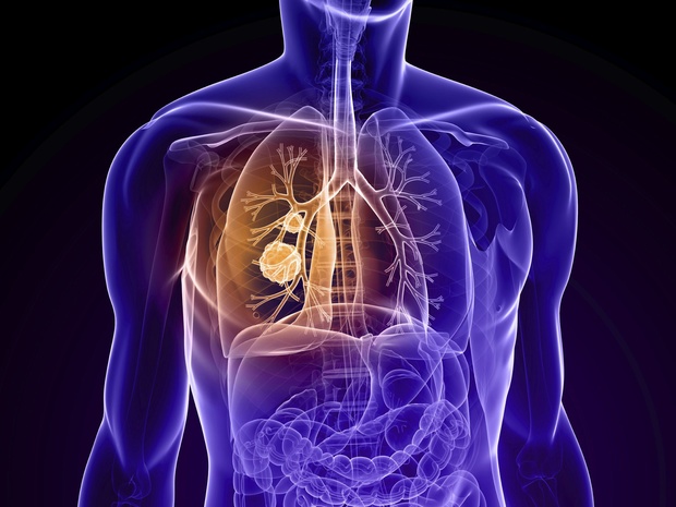 Apothekers helpen bij begeleiding COPD-patiënten
