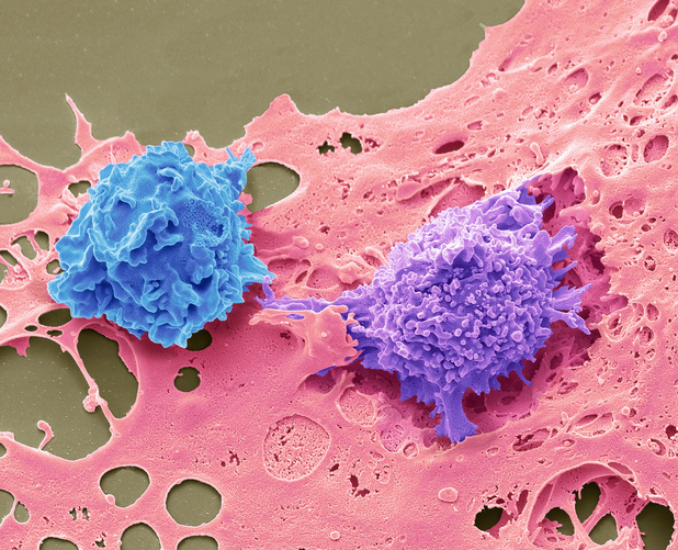 Minimale adjuvante chemotherapie bij hepatoblastoom
