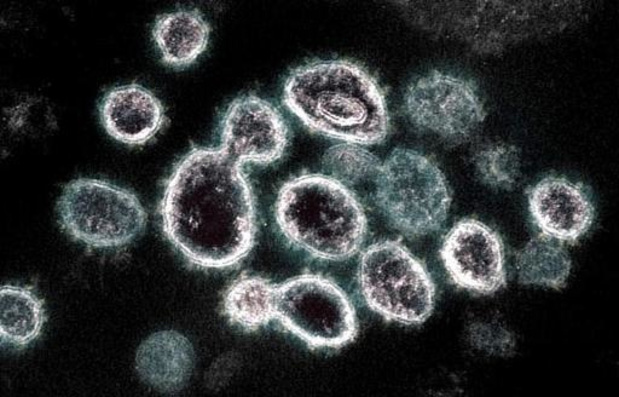 Coronavirus - Coronavirus verliest besmettelijkheid al na paar minuten in lucht