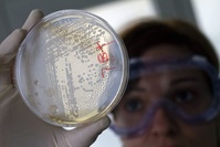 La résistance aux antibiotiques, l'autre fléau qui menace gravement la population mondiale