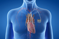 Mise au point d'un pacemaker expérimental entièrement résorbable